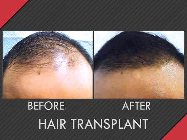 Image for MAXiM Hair Restoration with ID of: 2796534