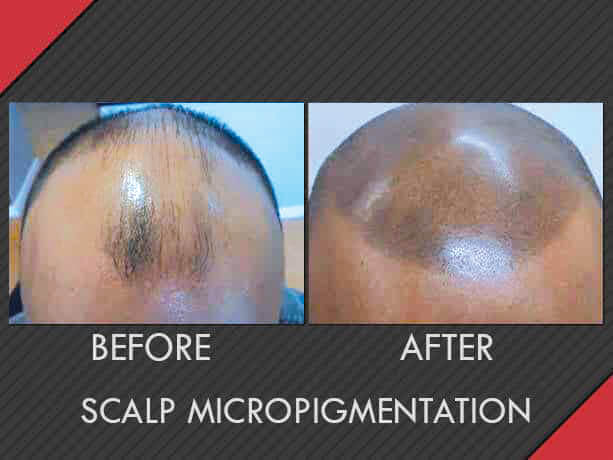 Image for MAXiM Hair Restoration with ID of: 2796535