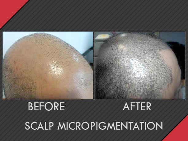 Image for MAXiM Hair Restoration with ID of: 2796536