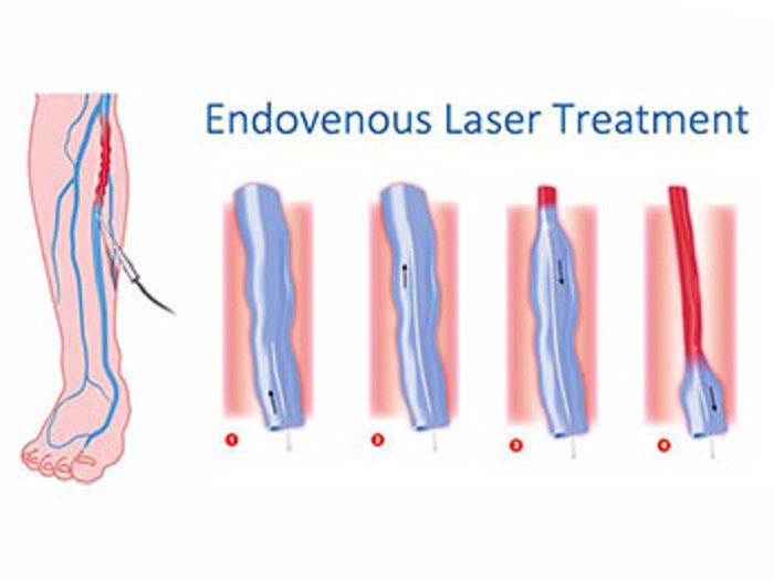 Image for Los Angeles Veins Center with ID of: 2798300