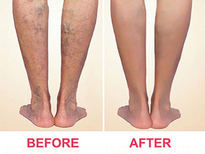 Image for Los Angeles Veins Center with ID of: 2798302