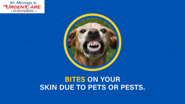 Image for Why You Should See a Dermatologist in Hattiesburg? with ID of: 2803332