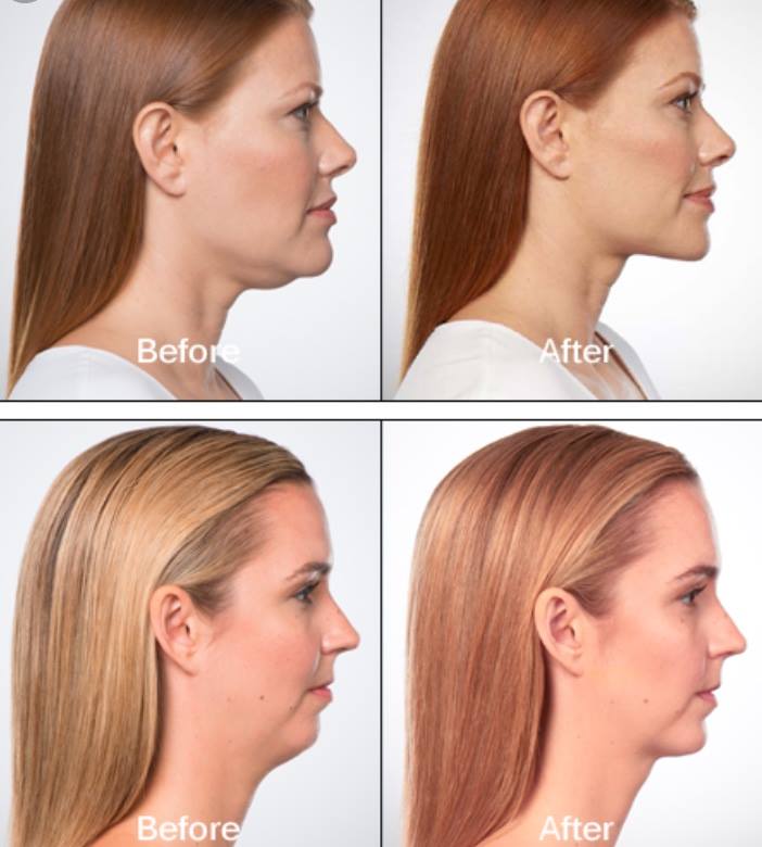 Image for Saul R Berger MD with ID of: 2836159