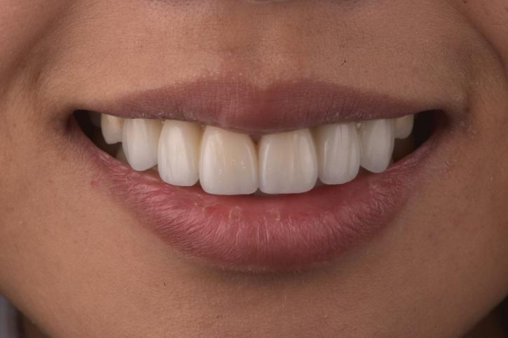 Image for Amsterdam Dental Group with ID of: 2840732