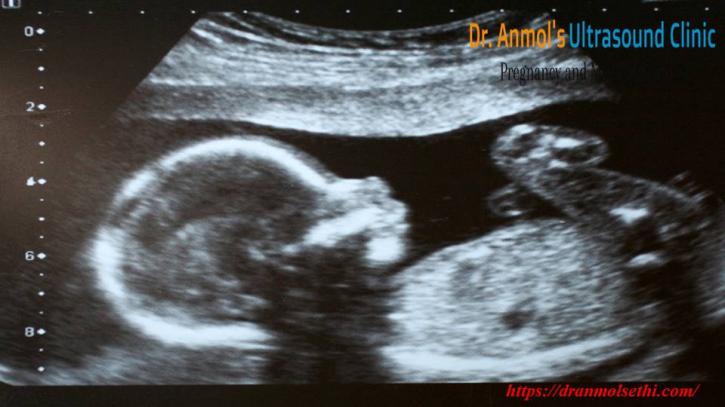 Image for Dr Anmols Ultrasound Clinic with ID of: 2846912