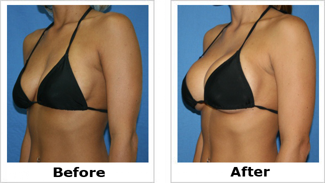 Image for LAYTON AESTHETIC PLASTIC SURGERY with ID of: 2851263