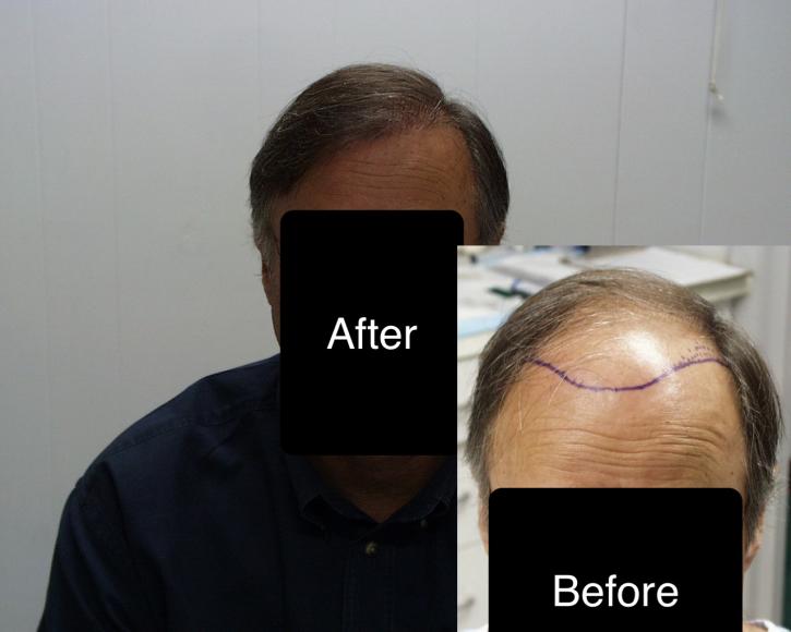 Image for AZ Hair Restoration with ID of: 2854301