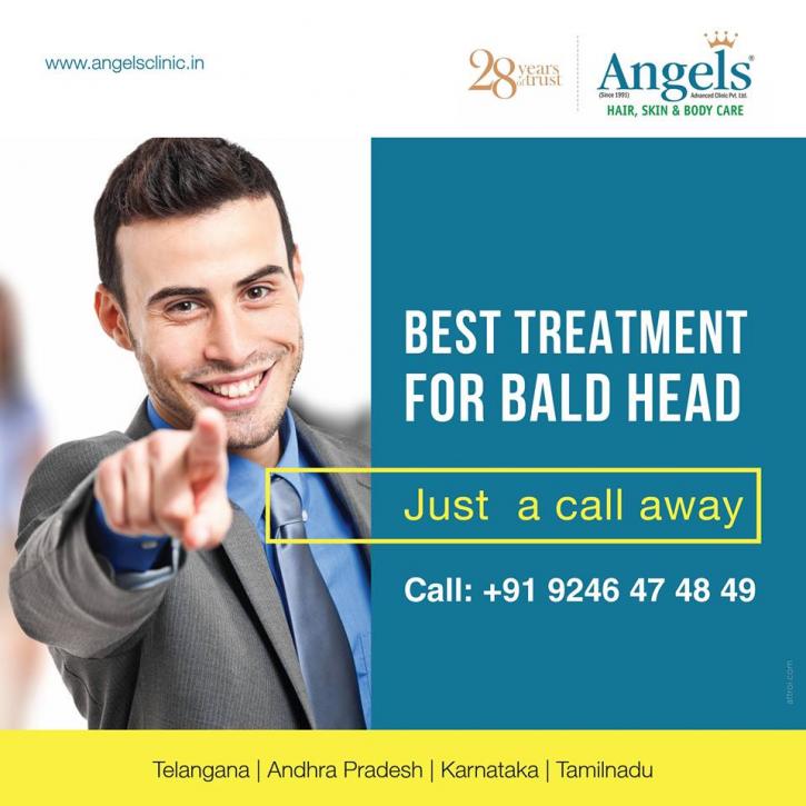 Image for Best Treatment for Baldness with ID of: 2861406