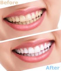 Image for World Class Smiles Created at Millard Roth, DDS with ID of: 2874970