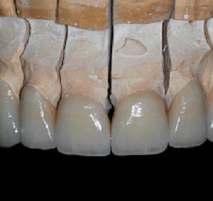 Image for DG Dental Lab Paterson with ID of: 2875135