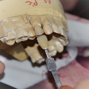Image for DG Dental Lab Paterson with ID of: 2875136