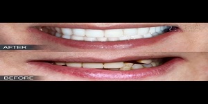 Image for Dental Crowns Lab Elizabeth with ID of: 2876265