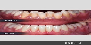 Image for Dental Crowns Lab Elizabeth with ID of: 2876267