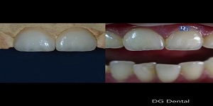 Image for Dental Crowns Lab Elizabeth with ID of: 2876268