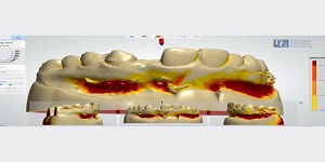 Image for Dental Crowns Lab Elizabeth with ID of: 2876269