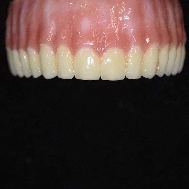 Image for Abutment Dental Paterson with ID of: 2877946