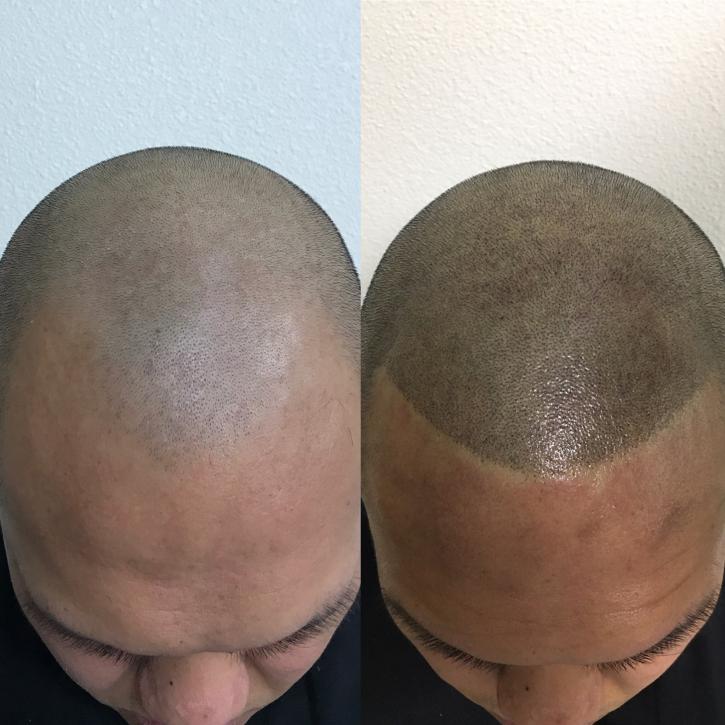 Image for Full Micropigmentation with ID of: 2887552