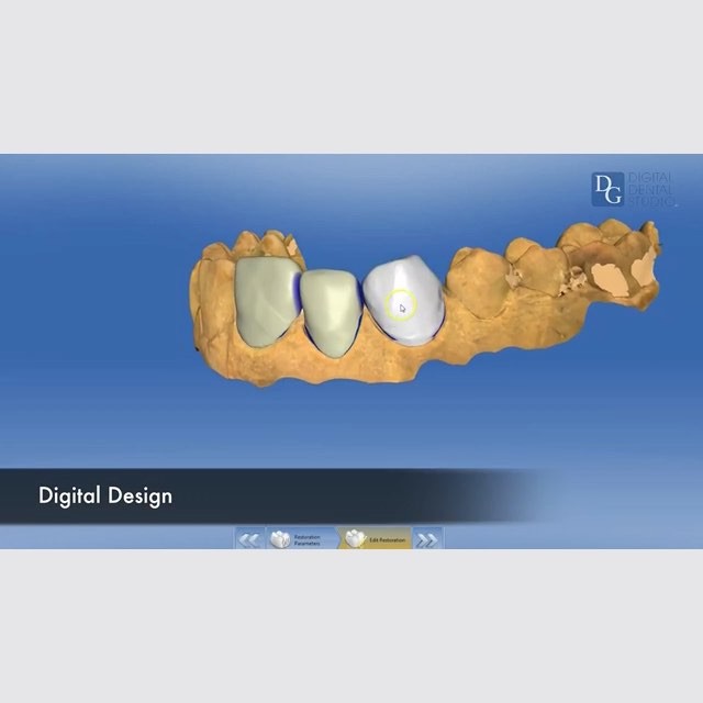 Image for Dental Crowns Lab Newark with ID of: 2908885