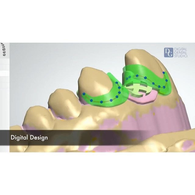Image for Dental Crowns Lab Newark with ID of: 2908888