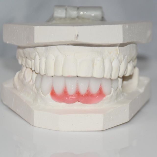 Image for Dental Crowns Lab Newark with ID of: 2908890