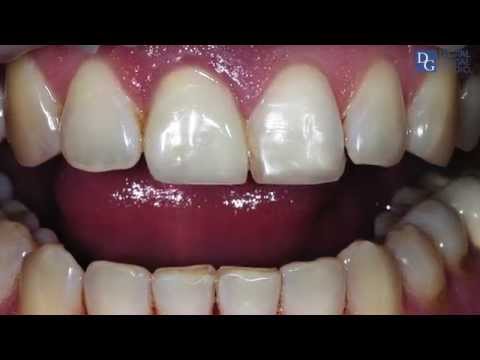 Image for DG Dental Lab with ID of: 2909262