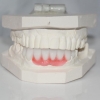 Image for Dental Crowns Lab with ID of: 2912269
