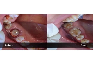 Image for DG Dental Lab Newark with ID of: 2915955