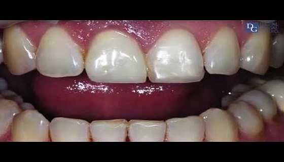 Image for DG Dental Lab Newark with ID of: 2915956