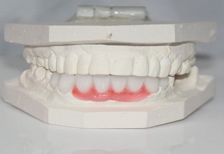 Image for DG Dental Lab Newark with ID of: 2915959