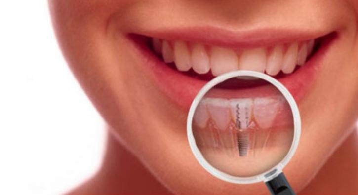 Image for Teeth whitening with ID of: 2917707