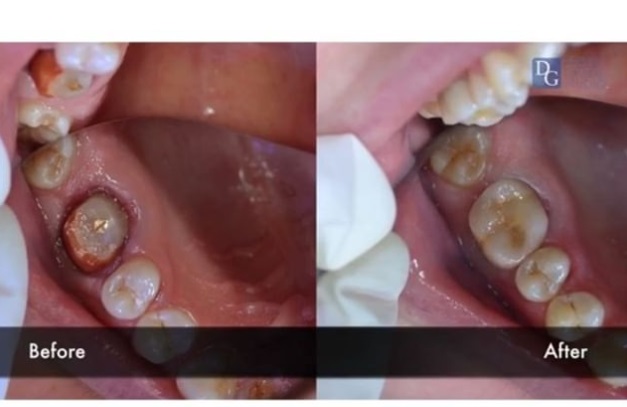 Image for DG Dental Lab with ID of: 2925603