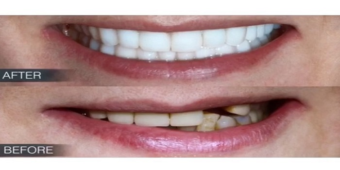 Image for DG Dental Lab NYC with ID of: 2936265
