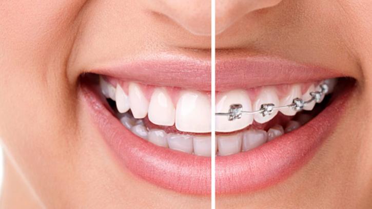 Image for Davis Orthodontics-Alliston with ID of: 2936775