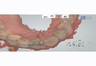 Image for Dental Crowns Lab Bronx with ID of: 2947125
