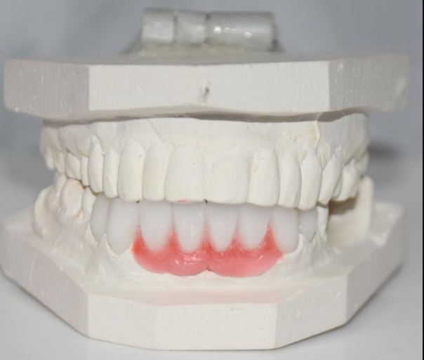 Image for DG Dental Lab with ID of: 2958790
