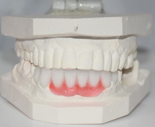 Image for Dental Crowns Lab NYC with ID of: 2966276