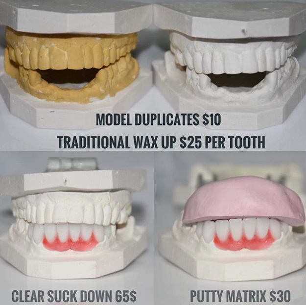 Image for Dental Crowns Lab NYC with ID of: 2966277