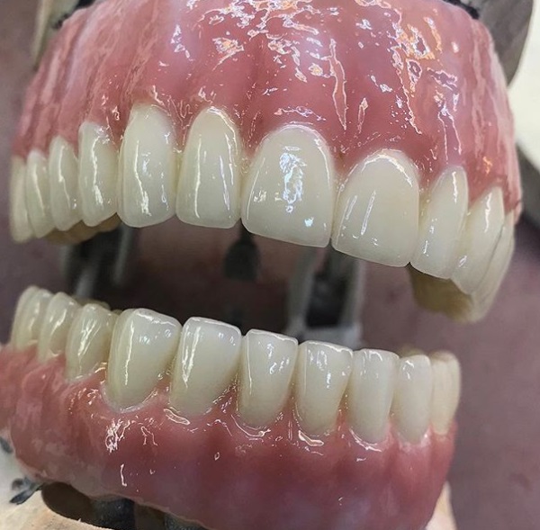 Image for Dental Crowns Lab NYC with ID of: 2966278