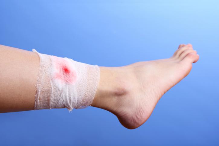 Image for Global Advanced Wound Care Market Size, Trend, Industry Analysis 2017-2024 with ID of: 2970139