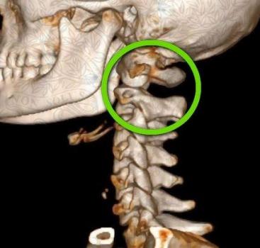 Image for Gaston Upper Cervical Chiropractic with ID of: 2977841