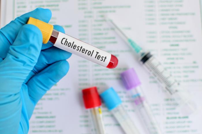 Image for Global Cholesterol Testing Market 2018-2025 - Industry Trends, Market Size, Segments, Growth Prospects: Data Bridge Market Research with ID of: 2980482