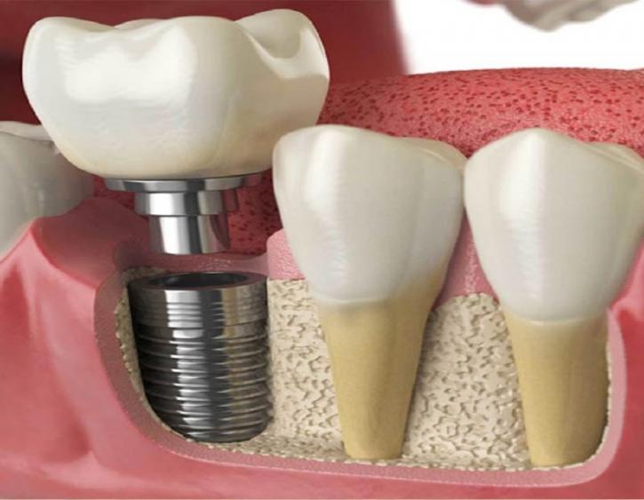 Image for Lara Village Dental with ID of: 2983643