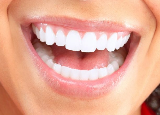 Image for Where to Get White Braces In Austin, TX with ID of: 2986245