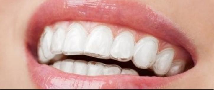 Image for No Limits Dental with ID of: 2989505