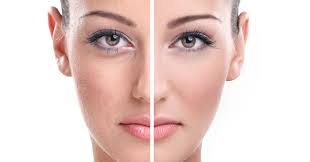 Image for Dark Circles Removal in Dubai with ID of: 2992532