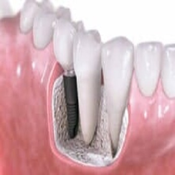 Image for Dental Lab Outsourcing with ID of: 2997582