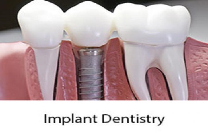 Image for Dental Serenity with ID of: 2998501
