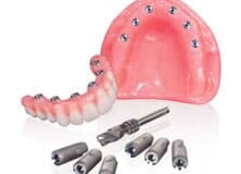 Image for Atlantic Dental Lab Newark with ID of: 2999733