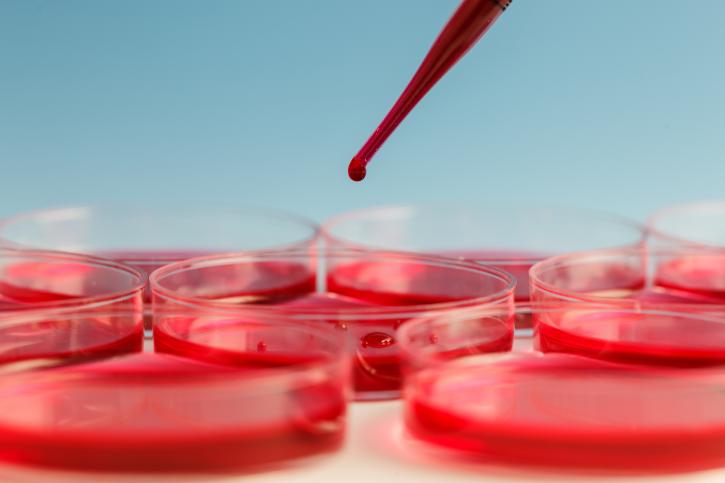 Image for Global Blood Screening Market: Driven by Increasing Organic Farming across the World with ID of: 3006507