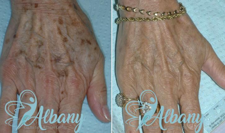 Image for Albany Cosmetic and Laser Centre with ID of: 3017109